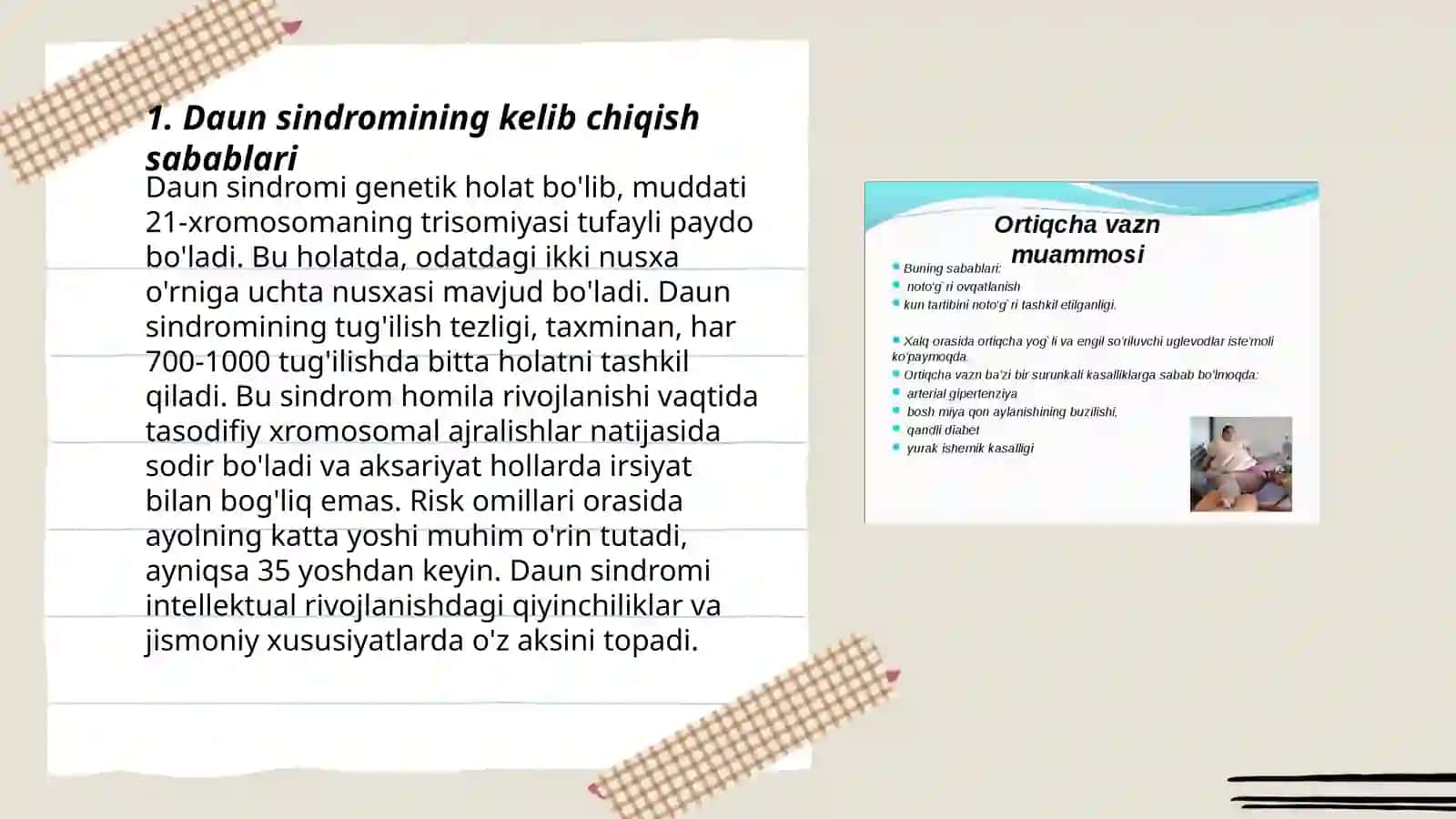Daun sindromining kelib chiqish sabablari 3