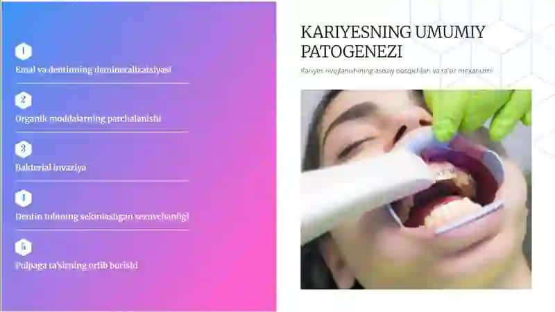 Kariyes bosqichlari 3