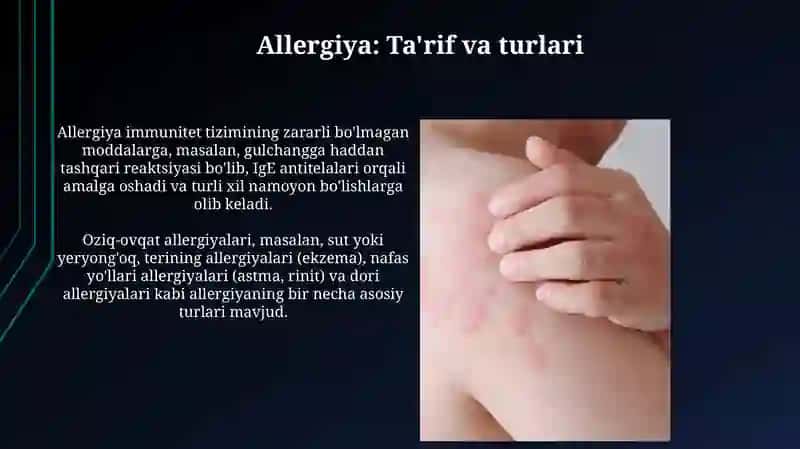 Allergiya: Ta'rif va turlari 3