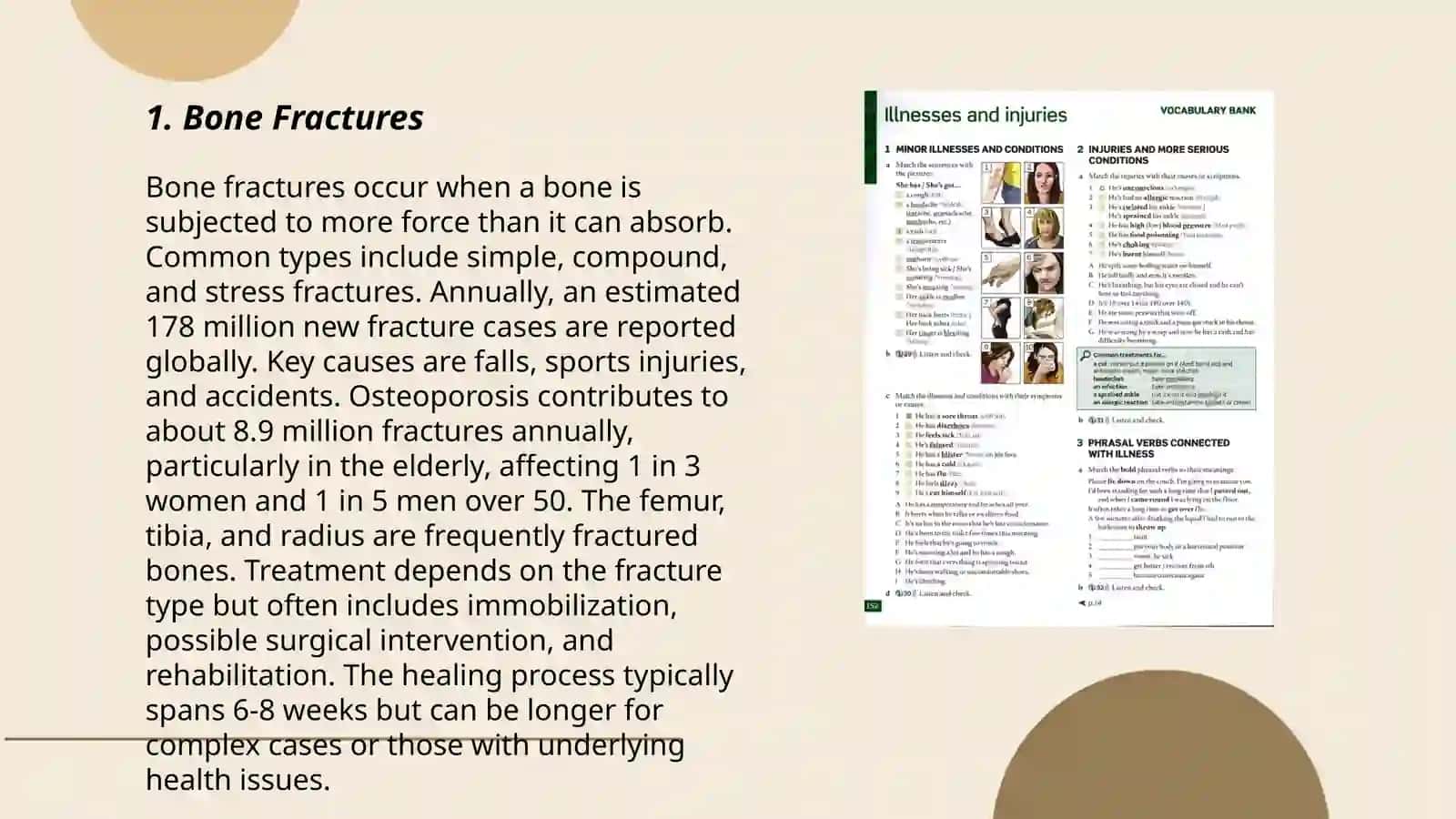 Bone Fractures 3