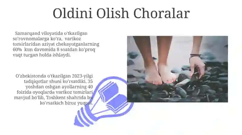 Oyoqlardagi varikoz 3