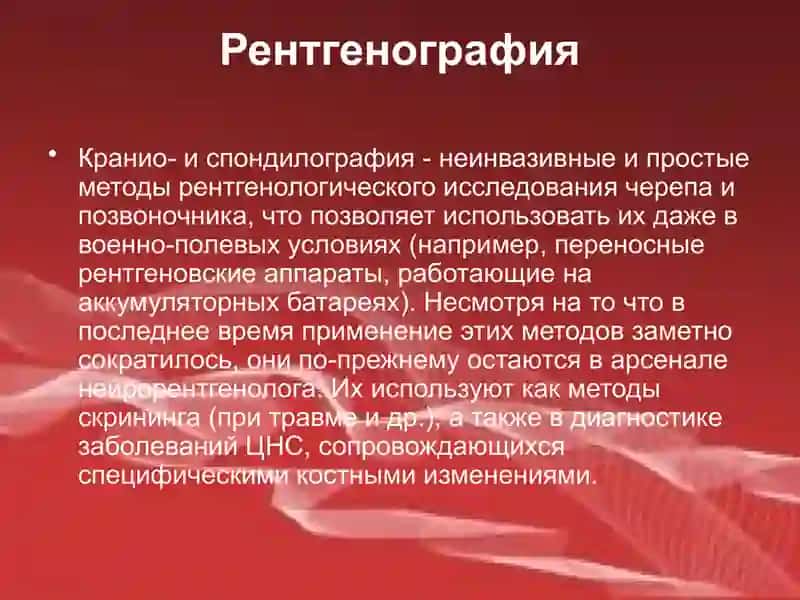 Методы лучевой диагностики в неврологии 3