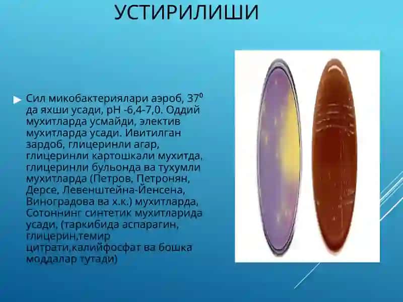 Туберкулез 3