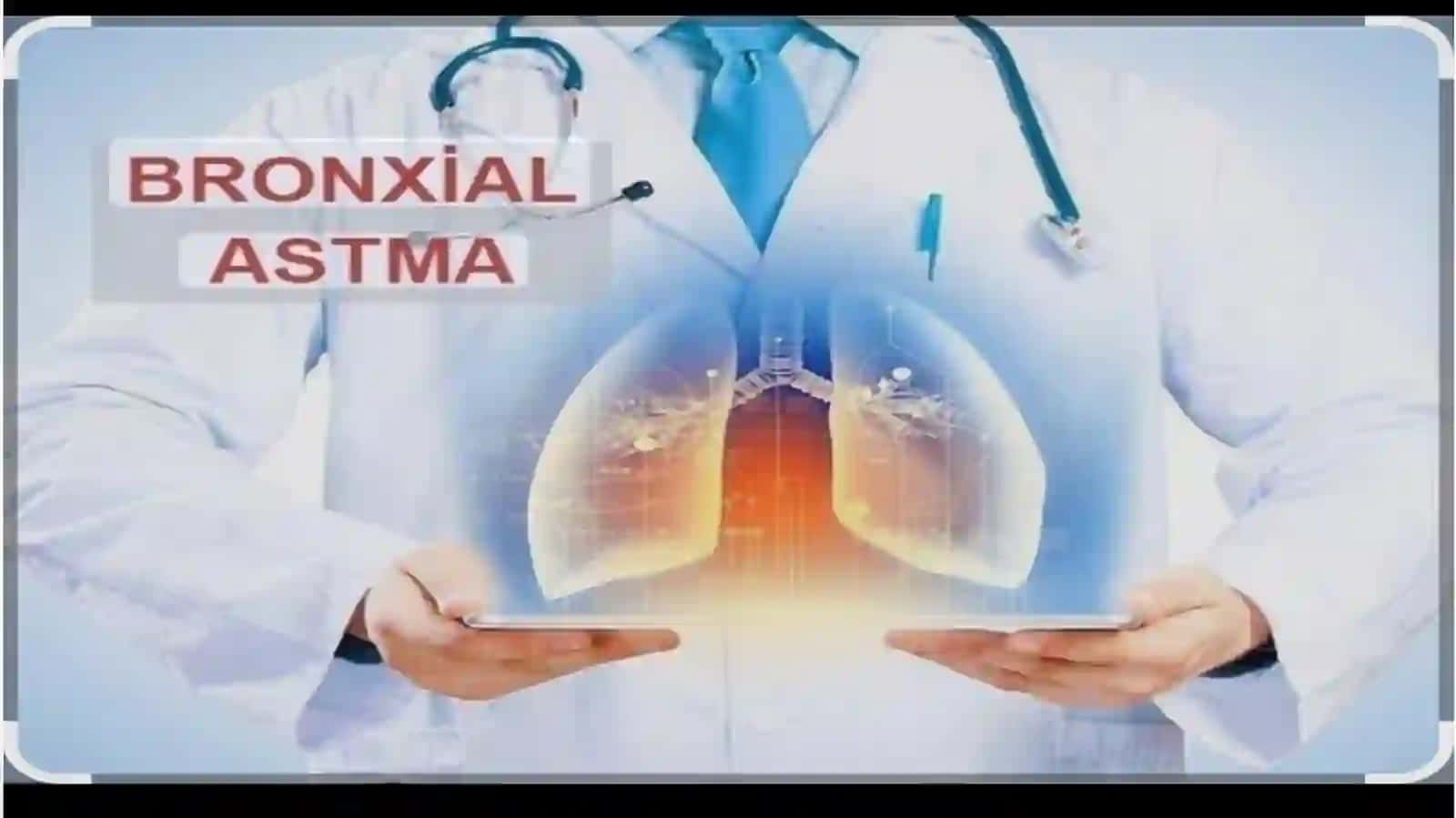 Bronxialastmaning farmakoterapiyasi 3
