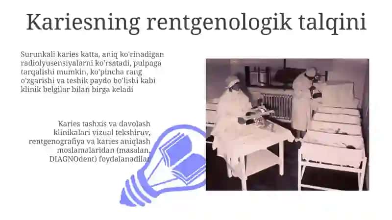 Oʼtkir va surunkali yuza karies klinikasi 3