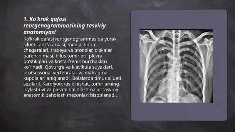 Ko‘krak qafasi rentgenogrammasining tahlili 3