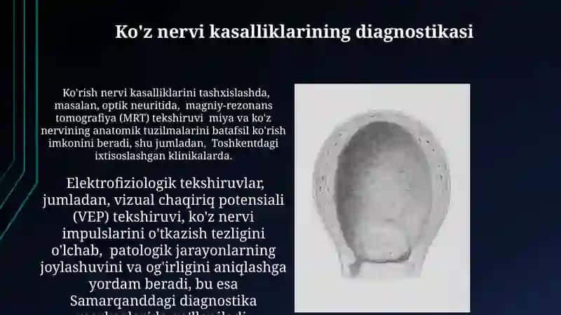 Ko'rish Nervi 3