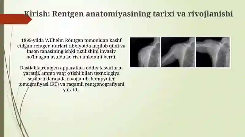 Rentgenoanatomiyada yangi texnalogiyalar 3