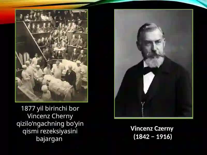 Qizilo'ngachning bo‘yin qismi rezeksiyasi 3