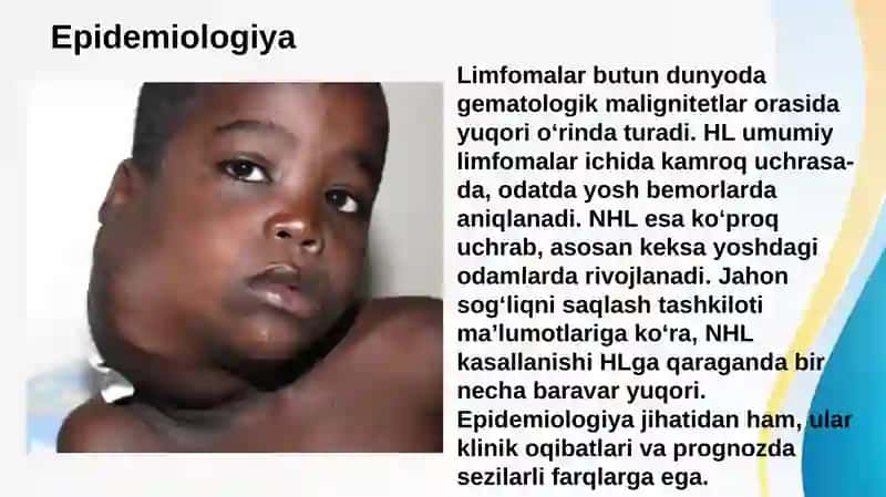 Hodjkin va Nohodjkin limfomasi . Ma'ruza uchun slayd 3