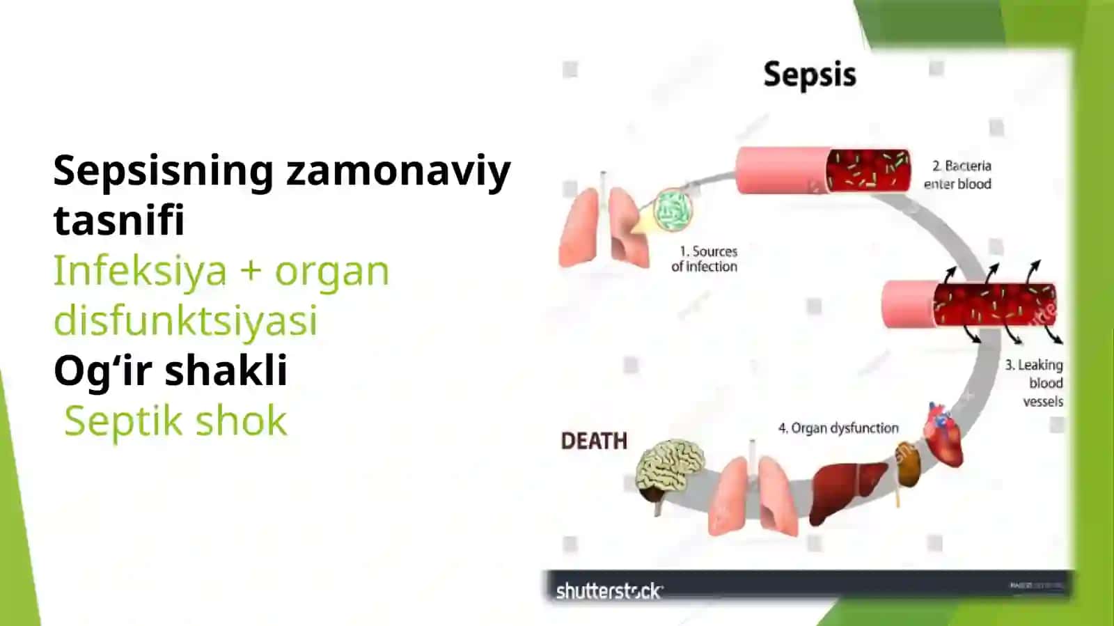 Sepsis xirurgiyasi 3
