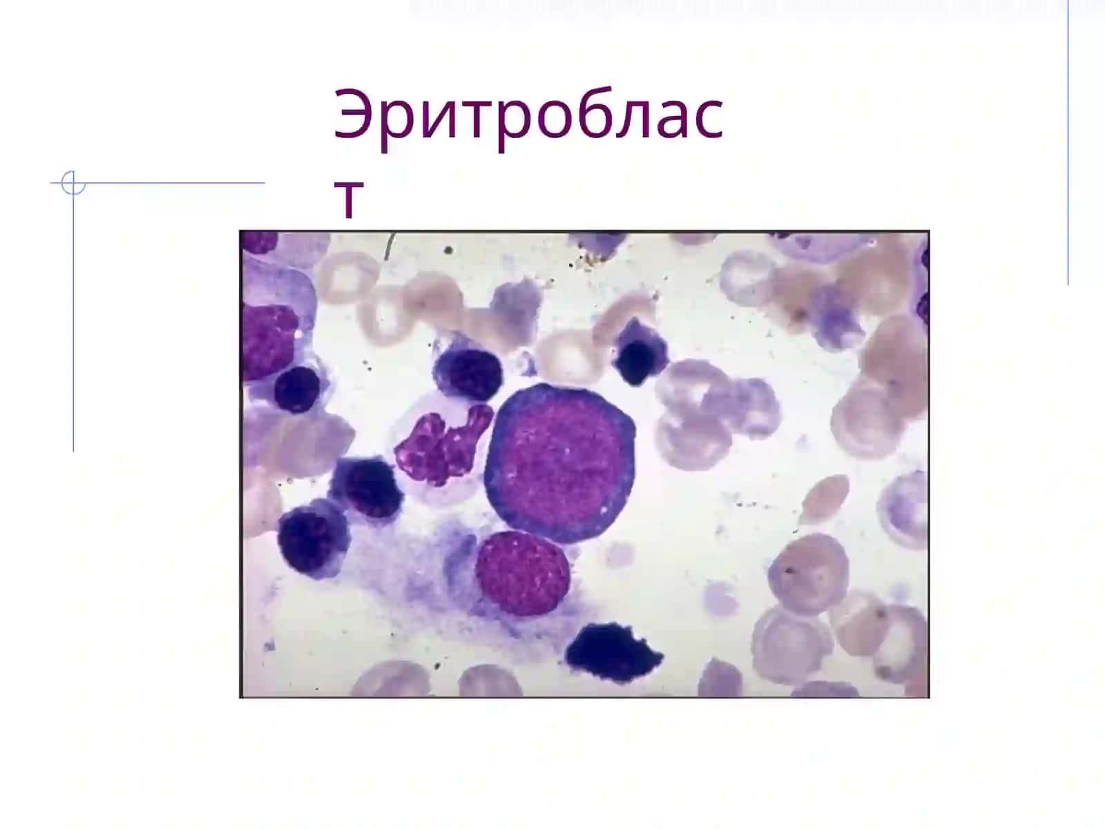 ERITROPOEZ XUJAYRALARINING MORFOLOGIYASI 3