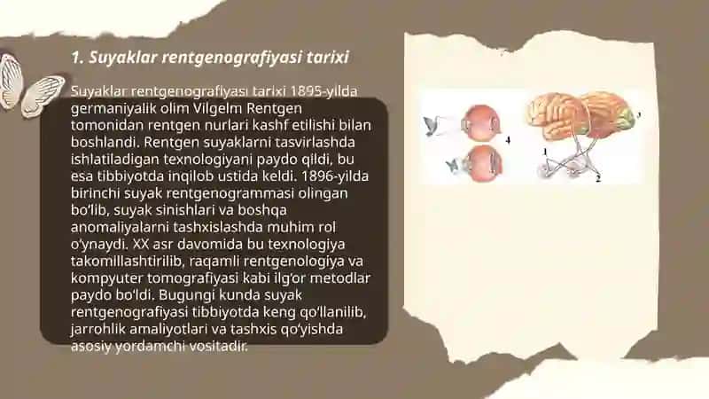 Suyaklar rentgenografiyasi 3