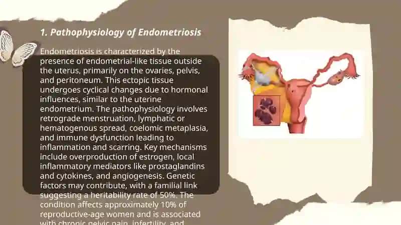 Endometriosis 3