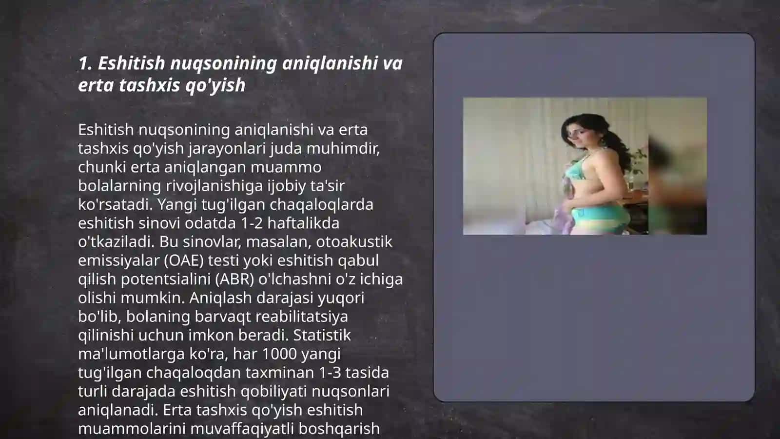 Eshitishda nuqsoni bo'lgan bolalar. Eshitishda nuqsoni bo'lgan bolalarni o'ziga xos xususiyatlari. Koxlear implantli bolalar 3