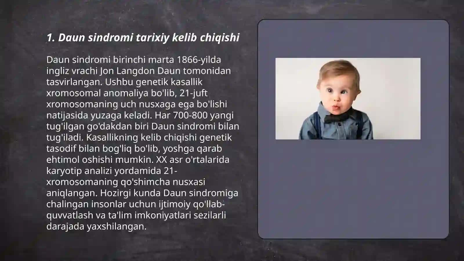 Daun sindromi 3