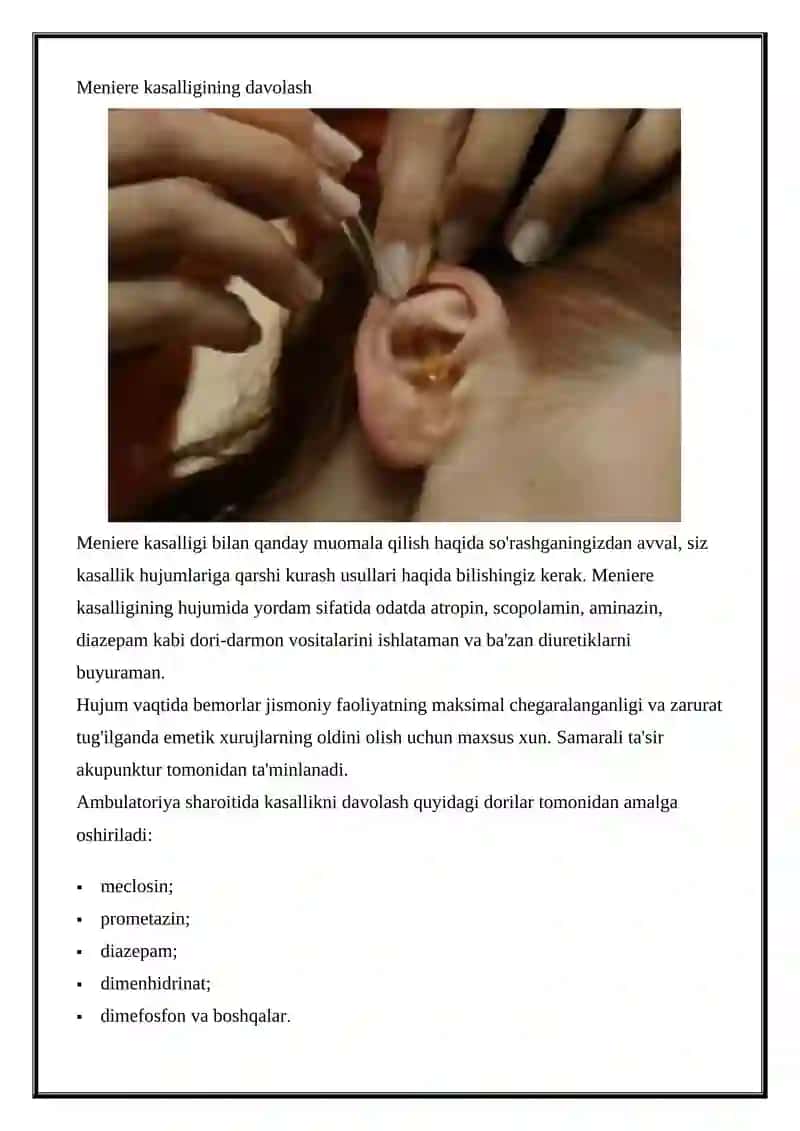 Meniere kasalligi davolash 3