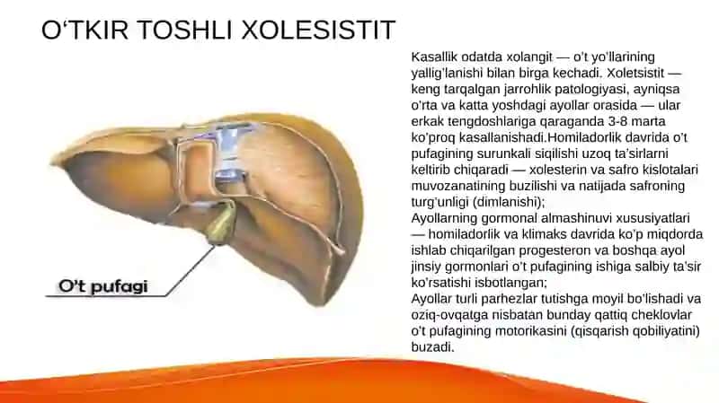 O‘TKIR TOSHLI XOLESISTIT 3