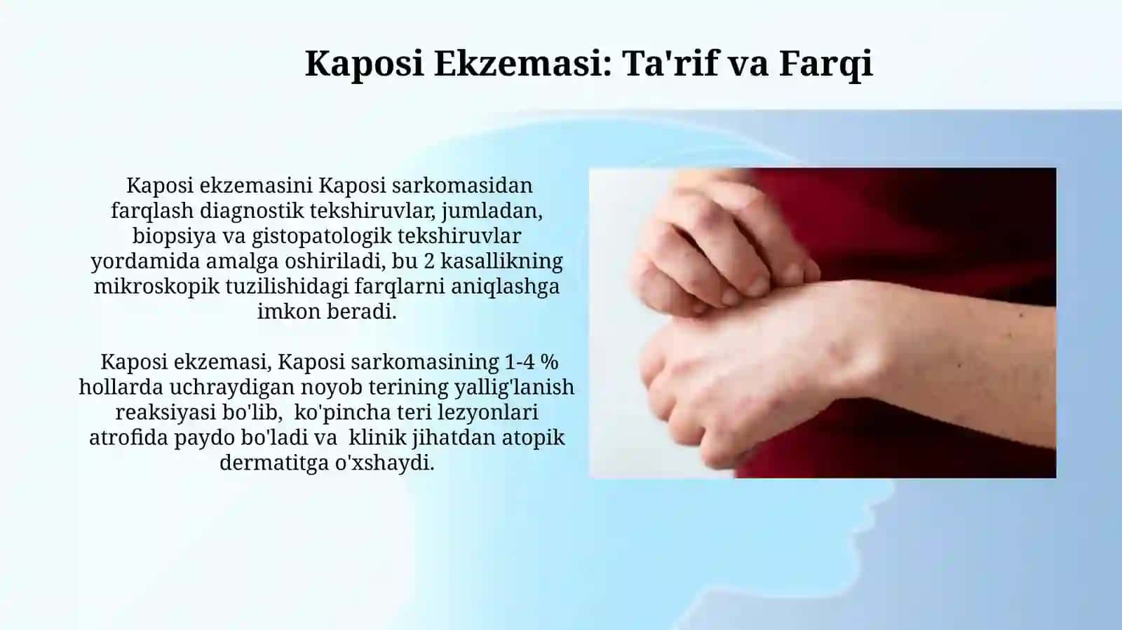 Kaposhi sarkomasi. Kaposhi ekzemasi 3