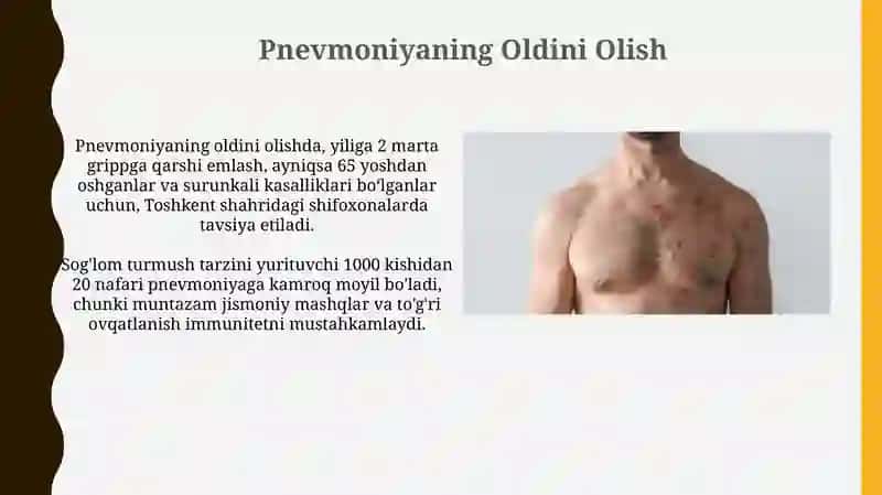 Gemolitik va Gemorragik Kasalliklar 3