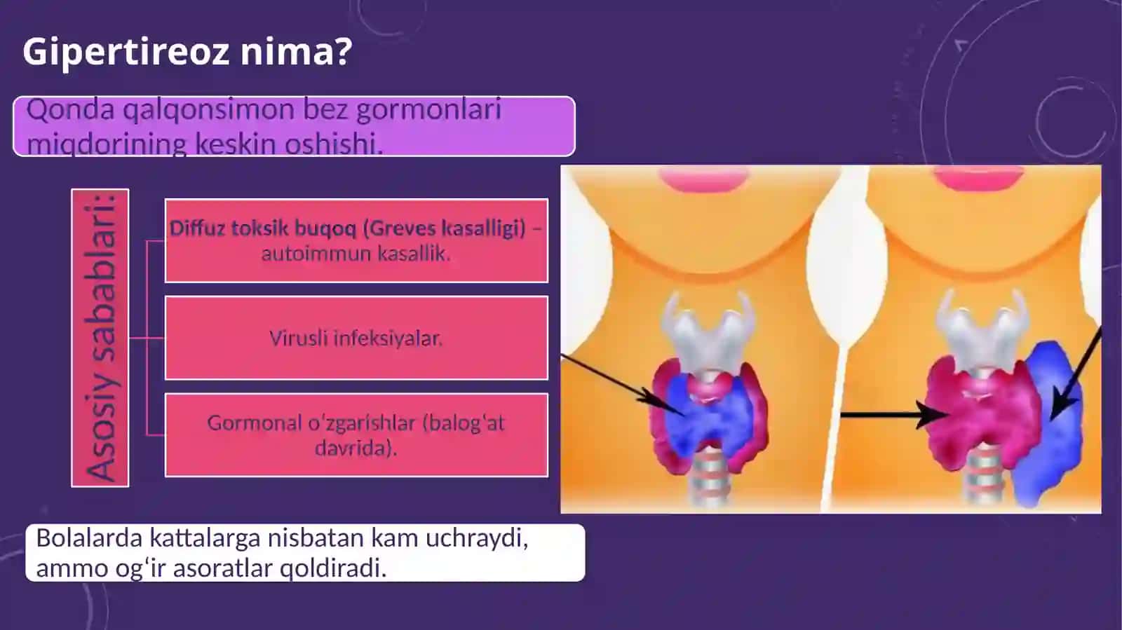 Gipertireoz va uning bolalarda nerv-psixik rivojlanishdagi ahamiyati. 3