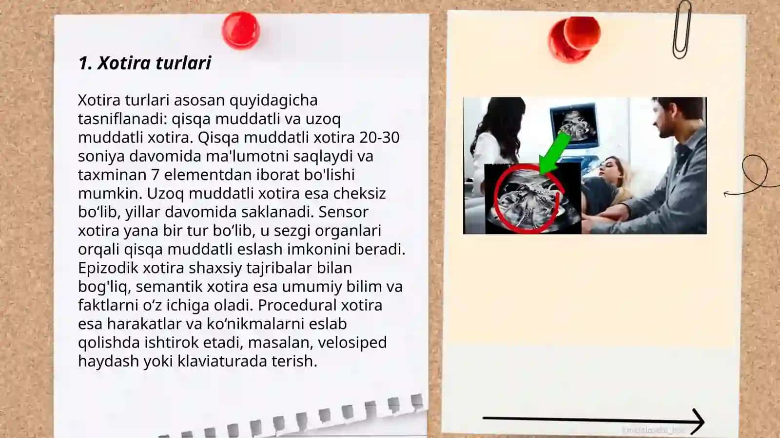 Xotiraning rivojlanishi 3