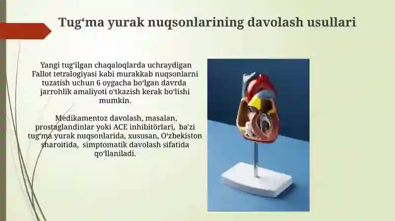Tug'ma yurak nuqsonlari 3