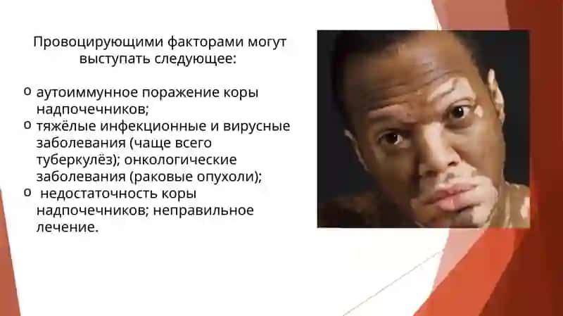 Бронзовая болезньили Болезнь Аддисона 3