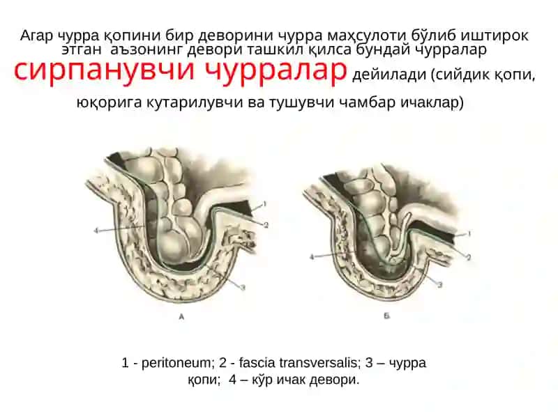 Қорин чурралари 3