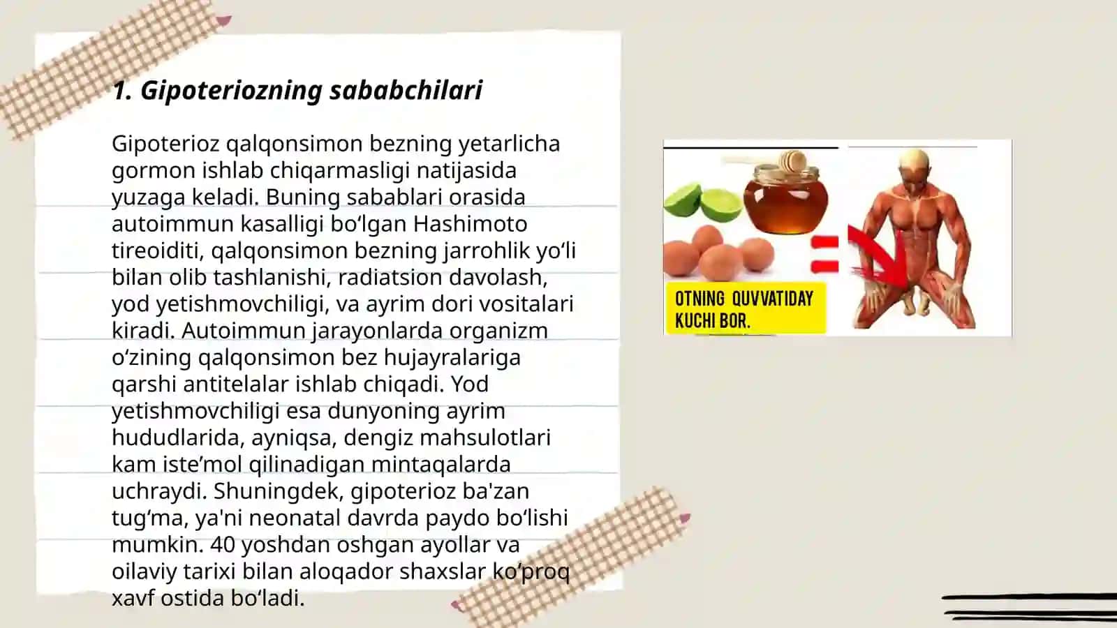 Endemik buqoq gipoterioz patogenezi va davolash usullari 3