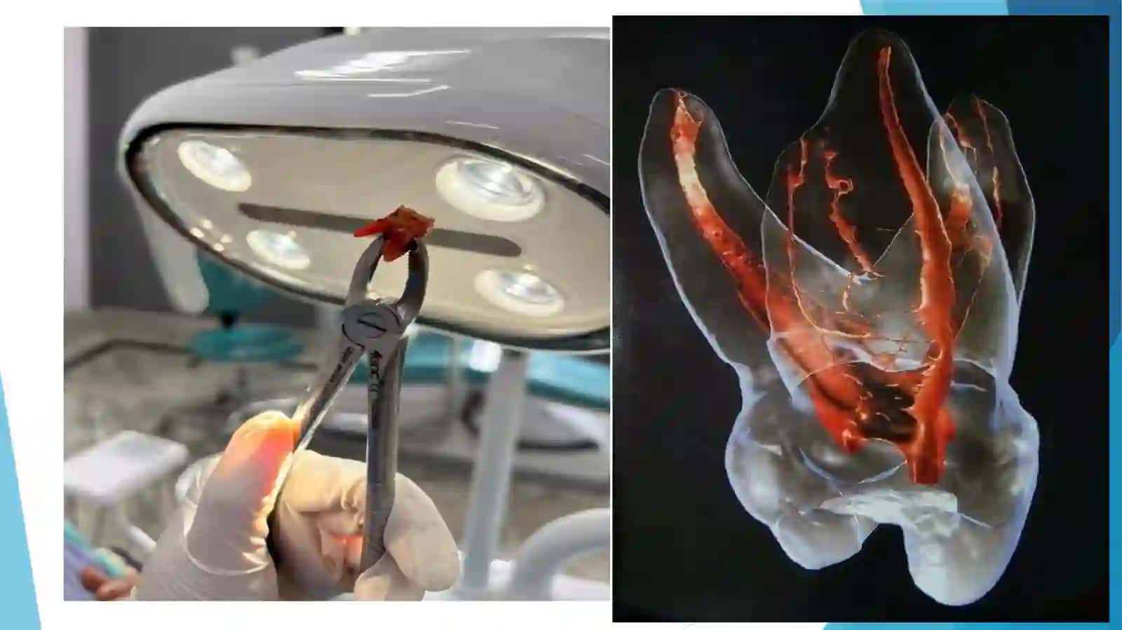 Tisholishoperatsiyasi 3