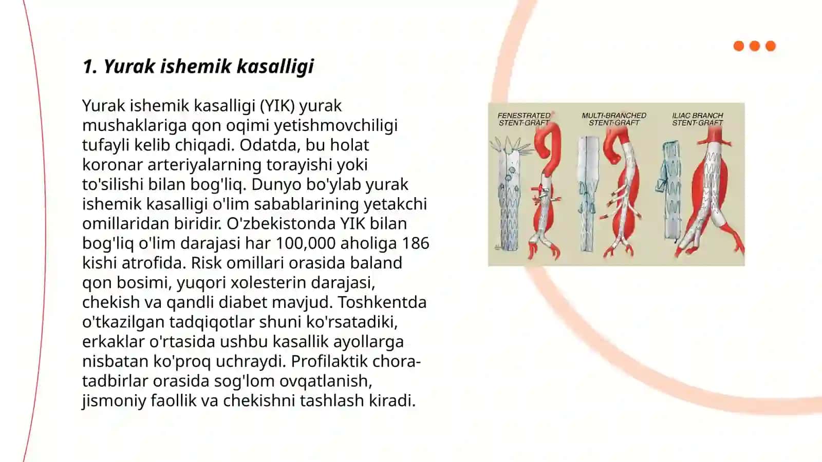 Yuraga stent qoyish 3