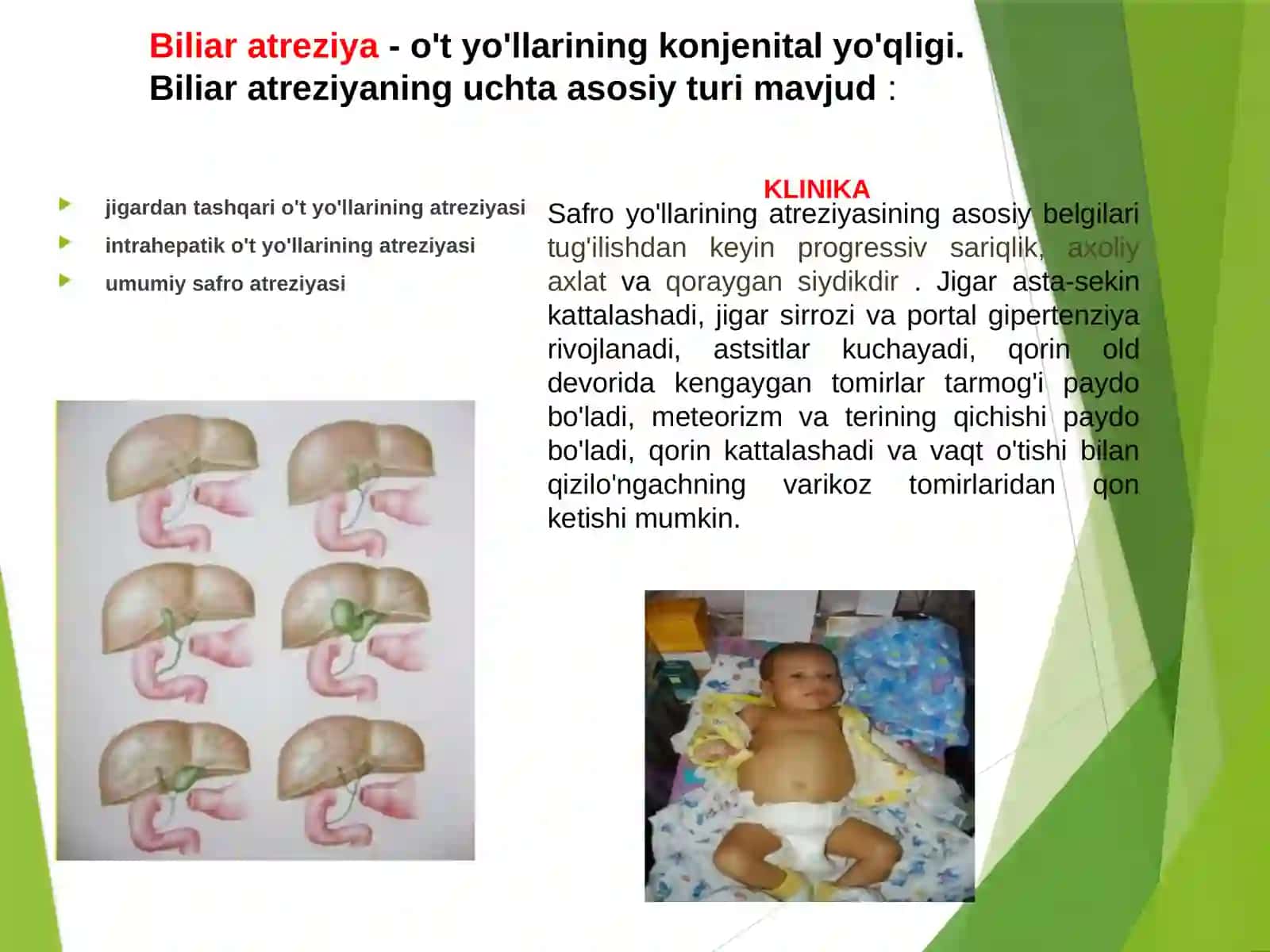 Jigar va o’t yo’llari kasalliklari 3