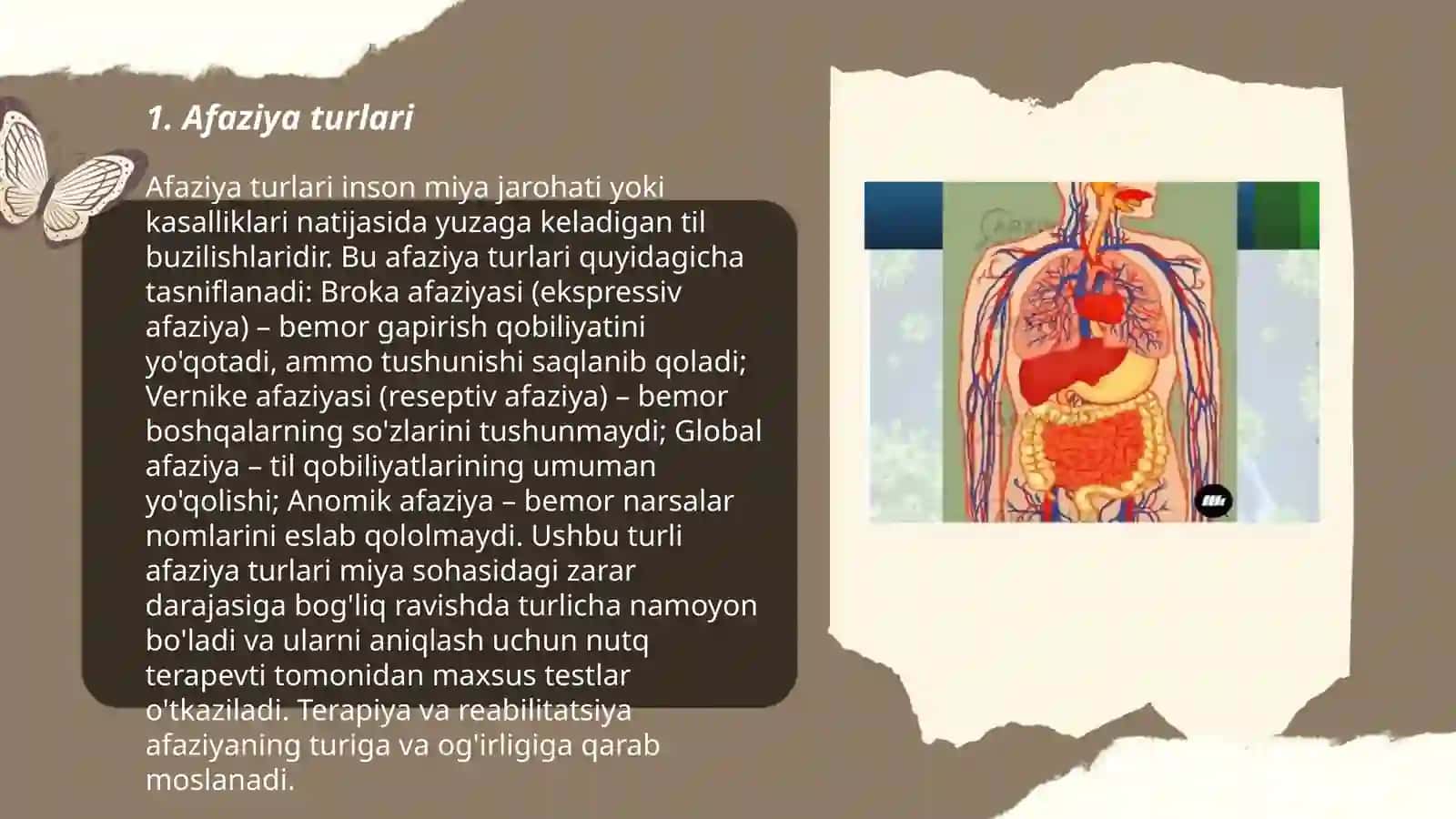 Afaziya sabablari mehanizmlari va tasnifi 3