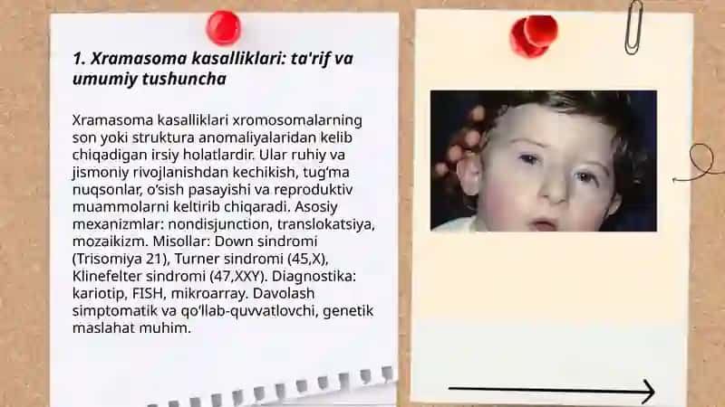 Xramasoma kasalliklari 3