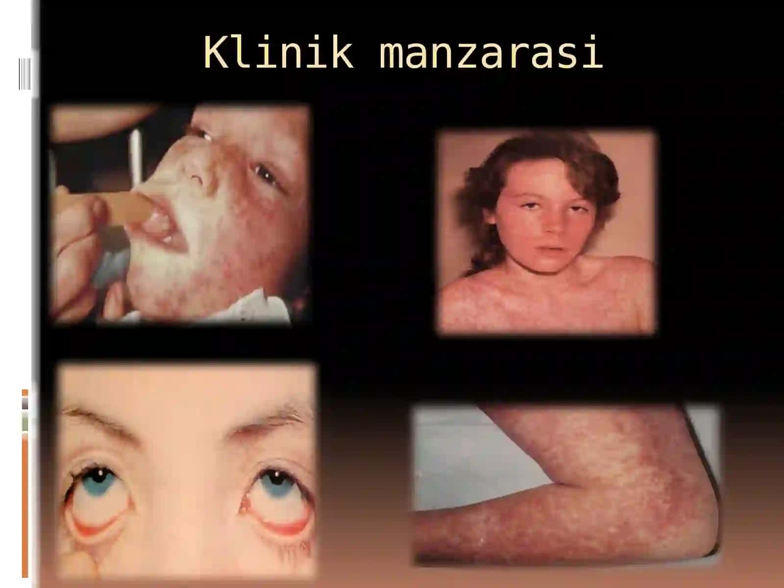 Yuqumli va yuqumsiz kasalliklar, Vitaminlar 3