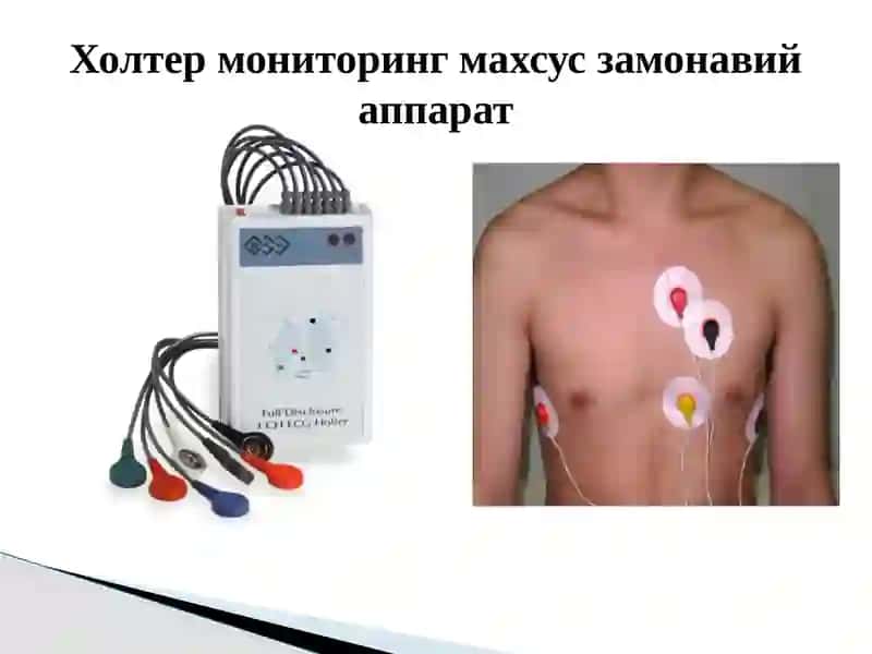 Юрак касалликларин изамонавий текшириусуллари 3