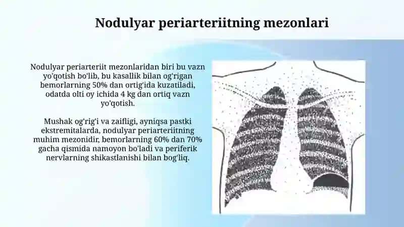 Nodulyar periarteriit va nospetsifik aortoarteriit 3