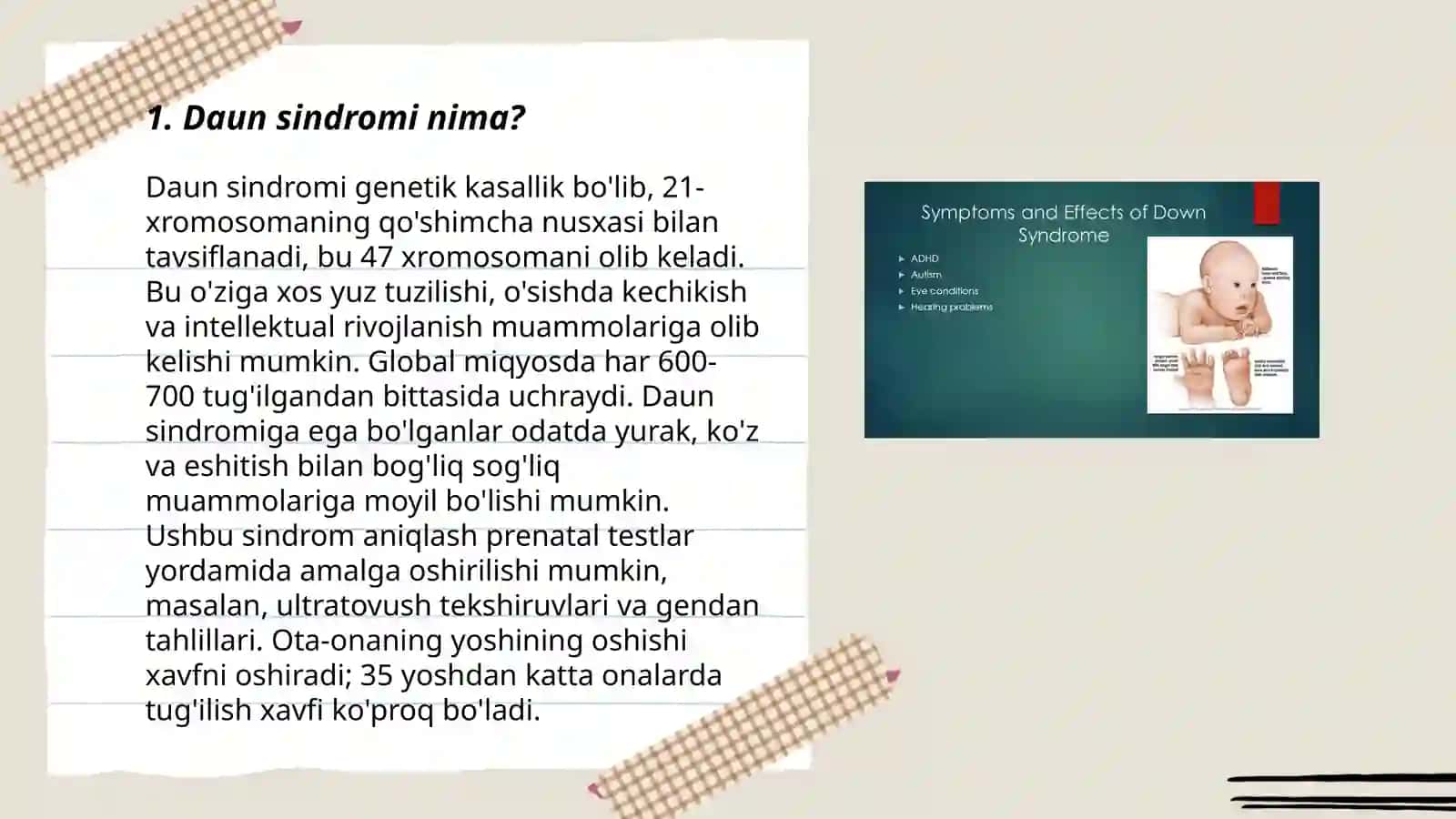Daun sindromi haqida maʼlumot 3