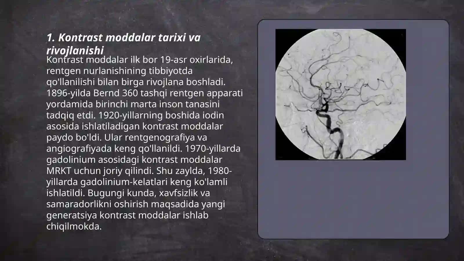 Nur tashxislash usulida kontras moddalarning xususiyati va turlari 3