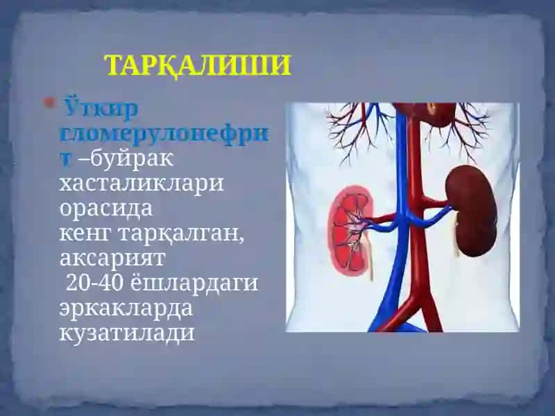 ГЛОМЕРУЛОНЕФРИТВАПИЕЛИОНЕФРИТ 3