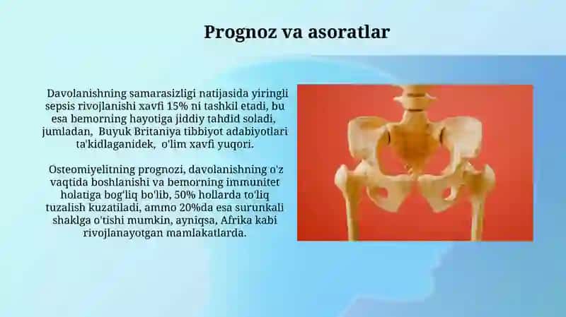 Osteomielit kasalligining patologikanatomiyasi 3