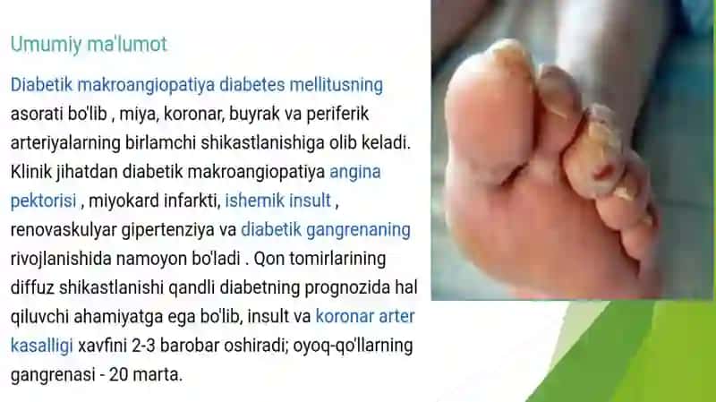 Diabetik makroangiopatiyalar 3