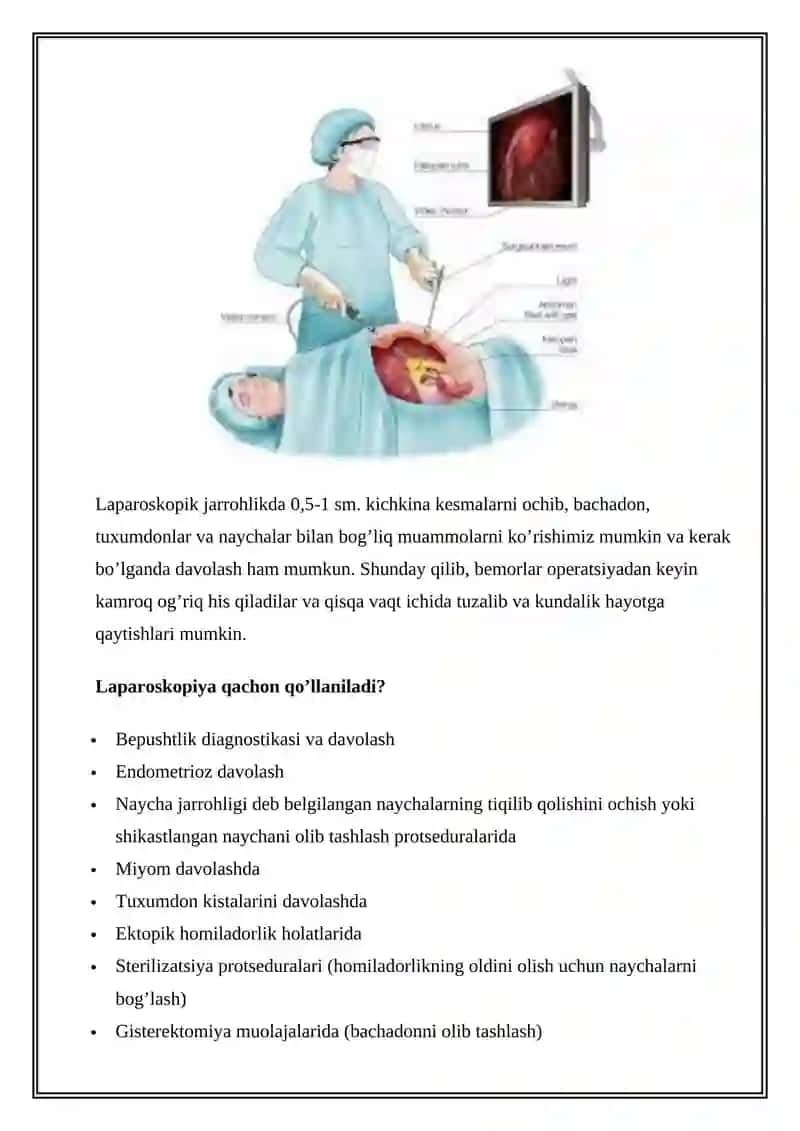 Laporoskopik operatsiyalar 3