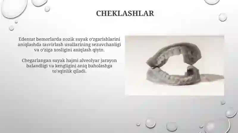 Diskriminatsion sezgirlik 3