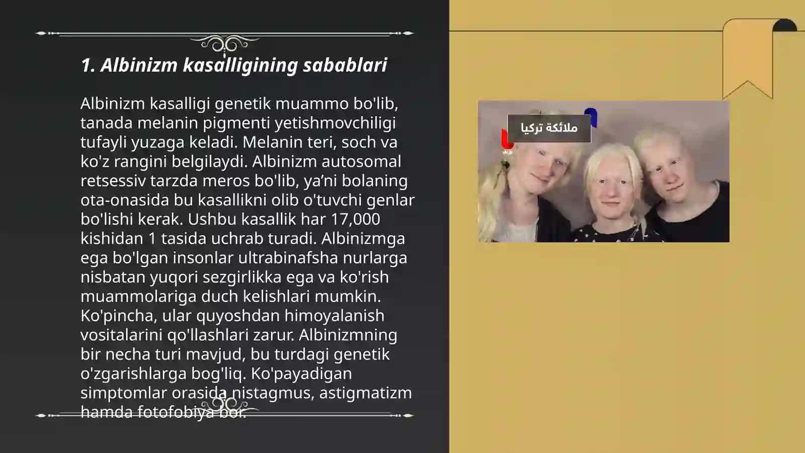 Albinizim kasaligi 3