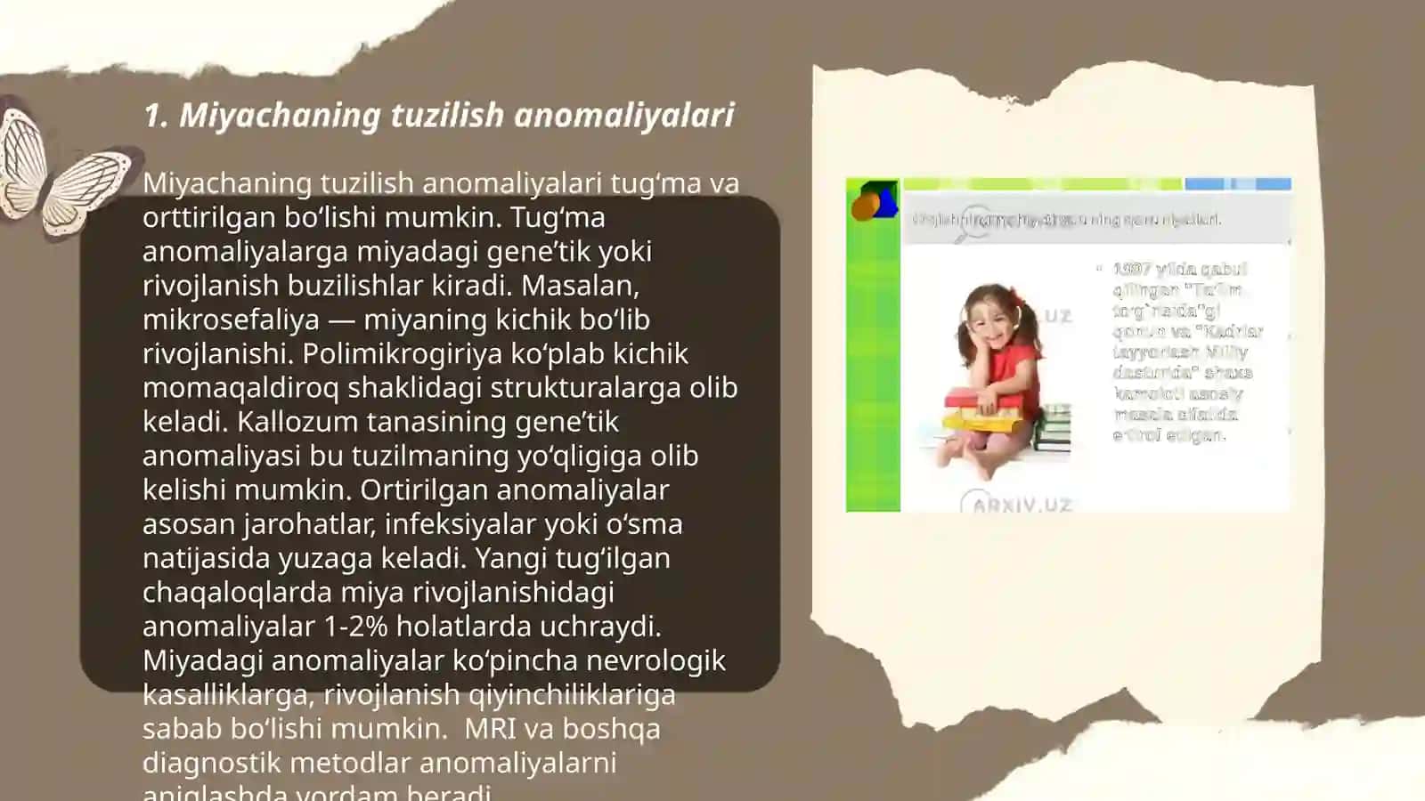 Miyacha rivojlanish anomaliyasi 3
