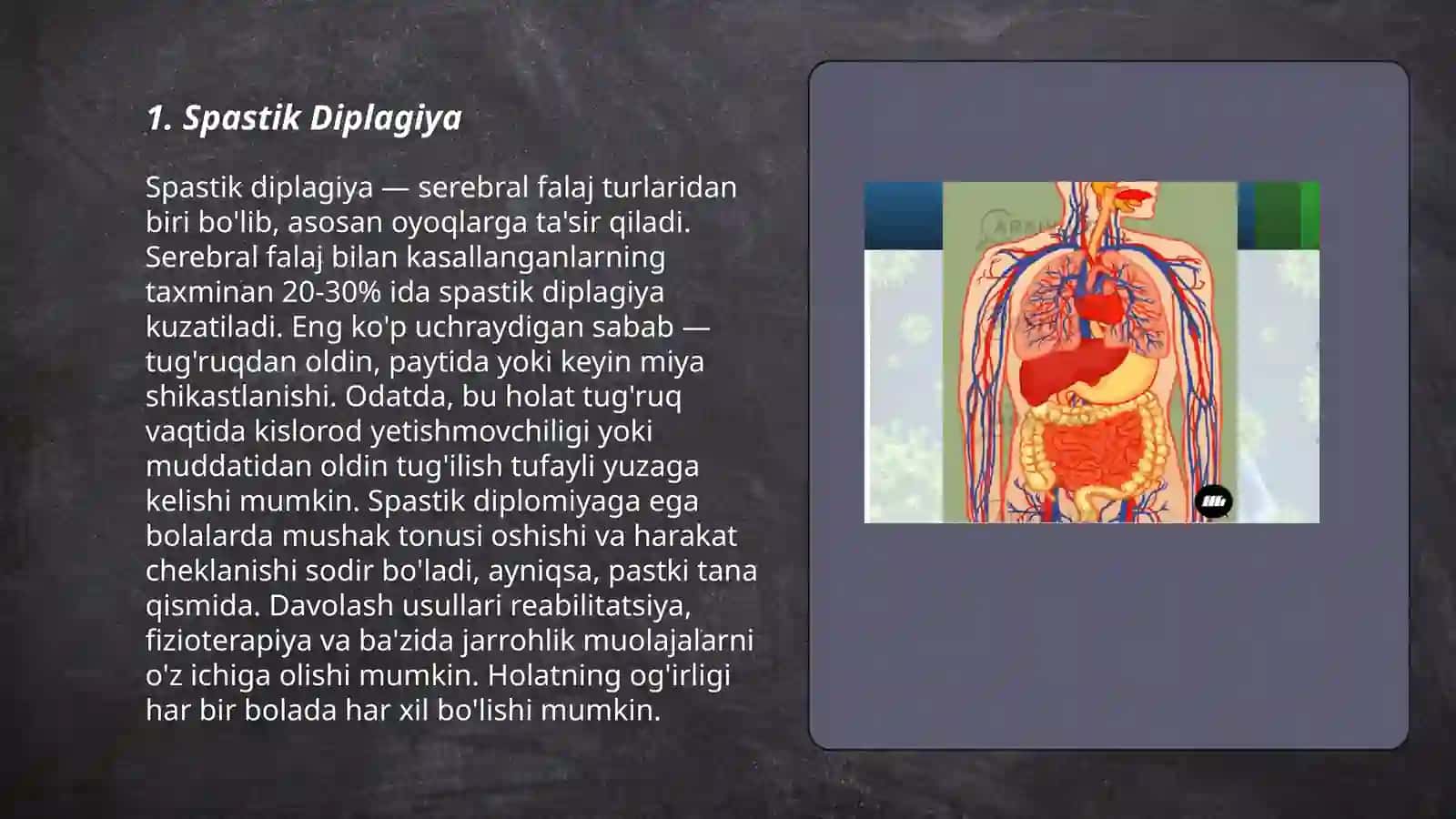 Bolalar miya falajining klinik shakillari 3