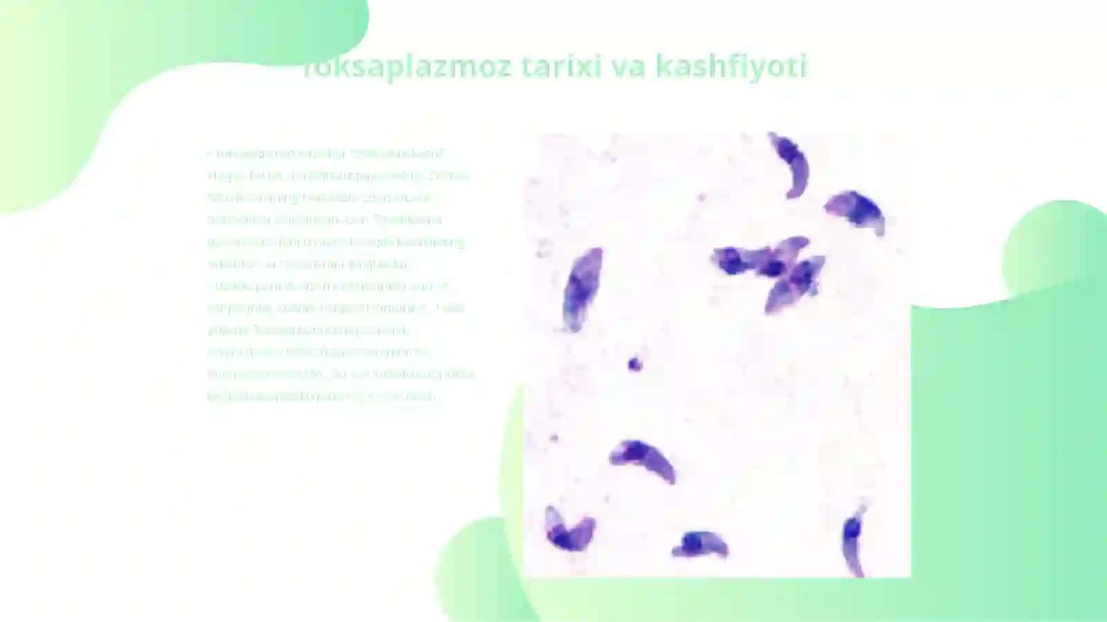 Toksaplazmoz 3