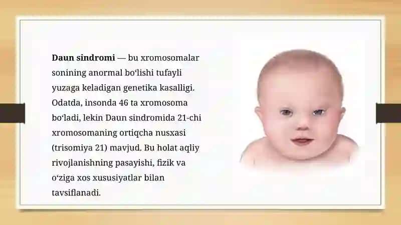 Daunsindromi Kasalliklari 3